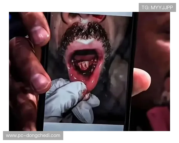 奇马耶夫解释推搡伊恩·加里原因，将接受脚部手术休战至2026年4月